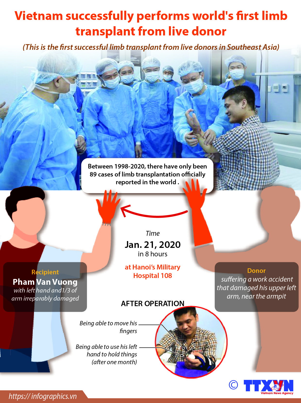 Vietnam successfully performs world's first limb transplant from live donor